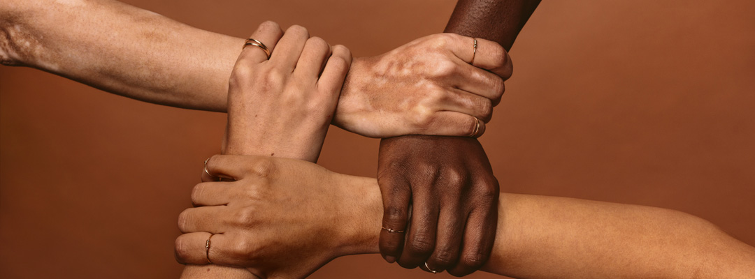 Ubuntu: Was würde Mandela tun?